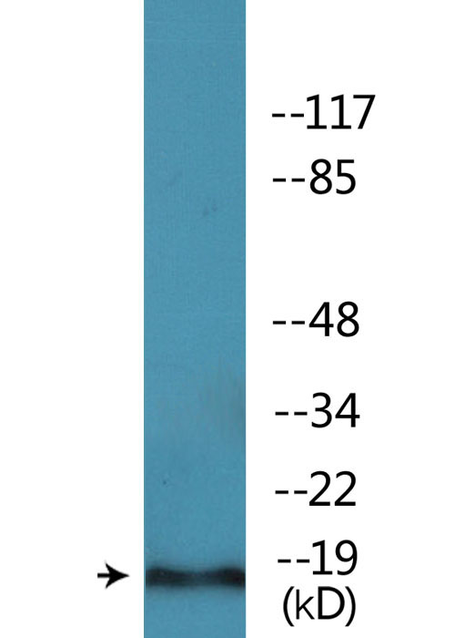 19