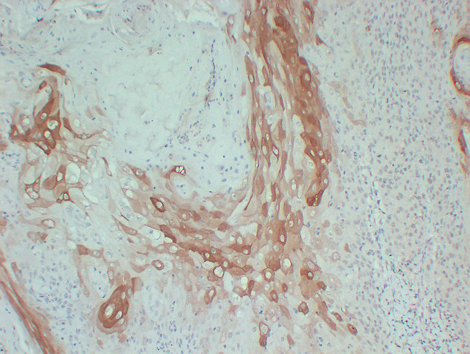 Keratin 10 CellBased ELISA Kit (CB5392) Assay Biotech Inc.